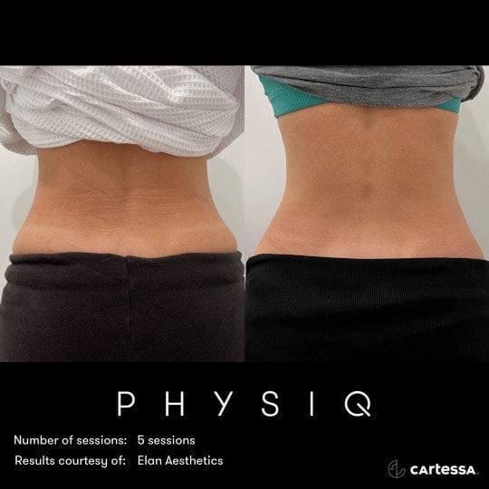 Physiq4