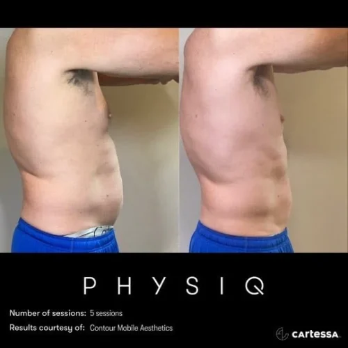 Physiq1
