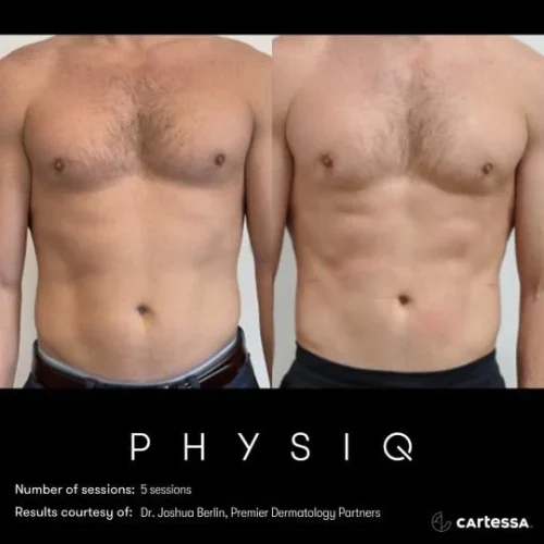 Physiq2