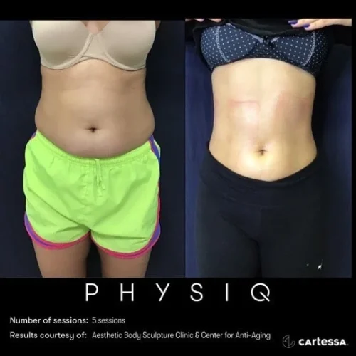 Physiq5