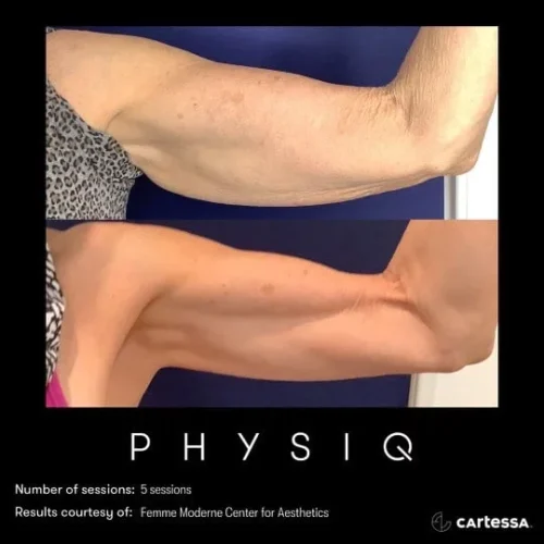 Physiq6